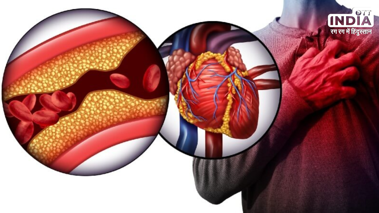 Heart And Blood Vessel Disease