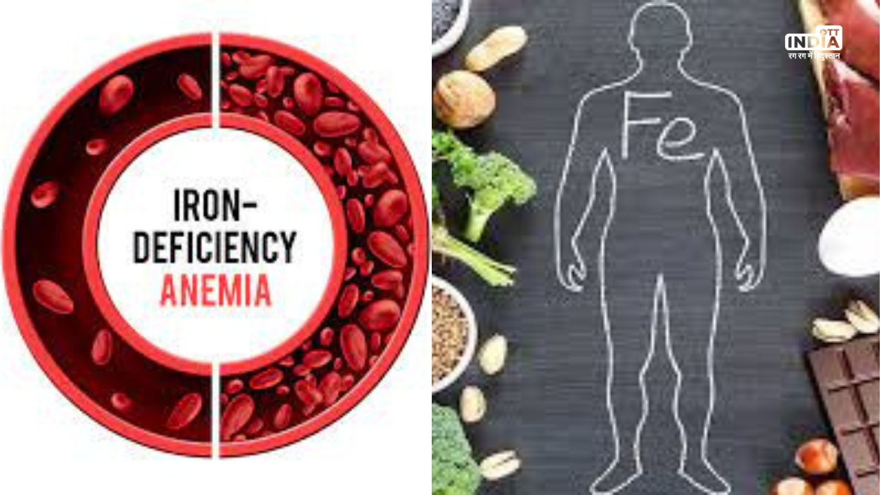 Iron Deficiency Anemia: सावधान! सिरदर्द या चक्कर को ना लें हल्के में, हो सकते हैं आयरन की कमी के संकेत