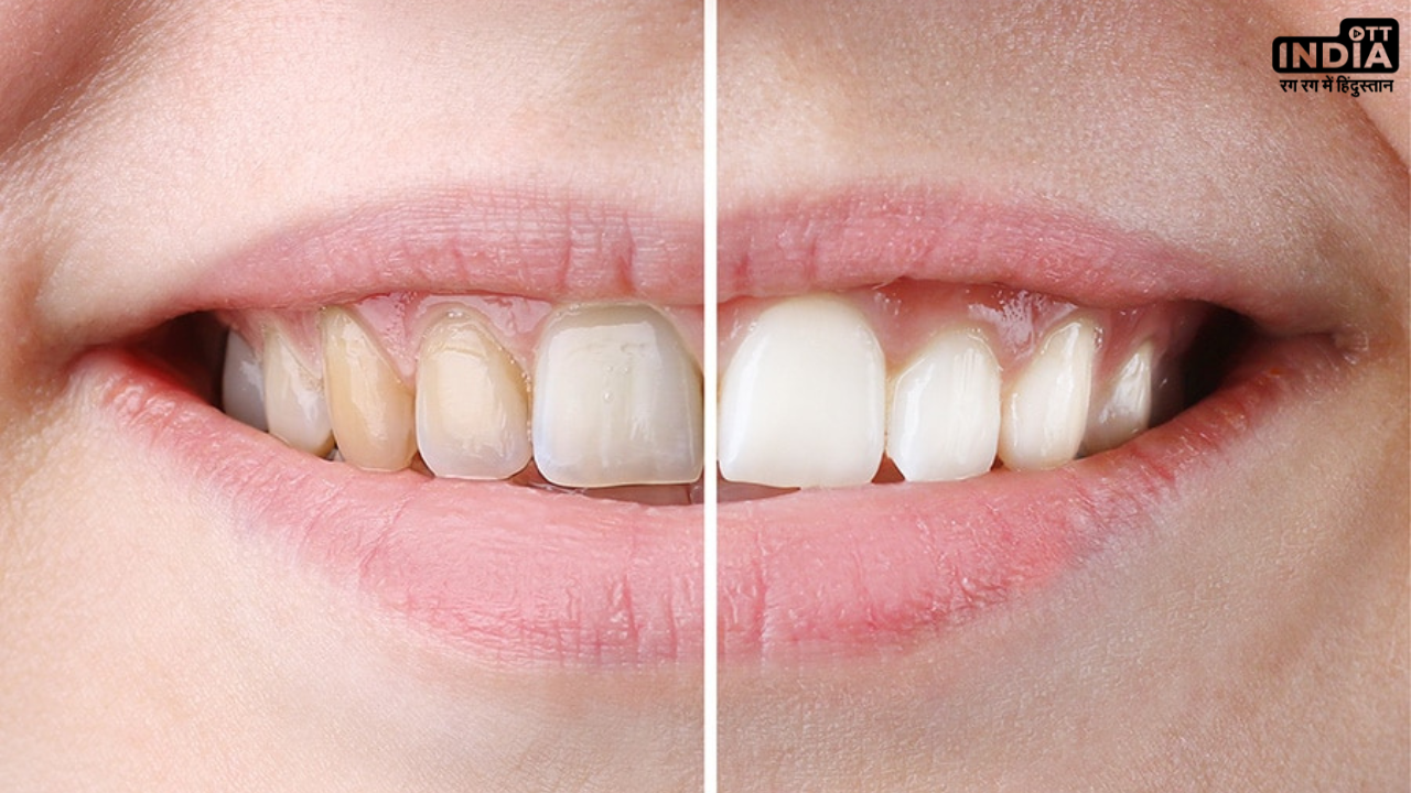 Teeth Whitening Tips: इन आसान घरेलु चीज़ों से अपने दांतों को बनायें स्ट्रांग और चमकदार