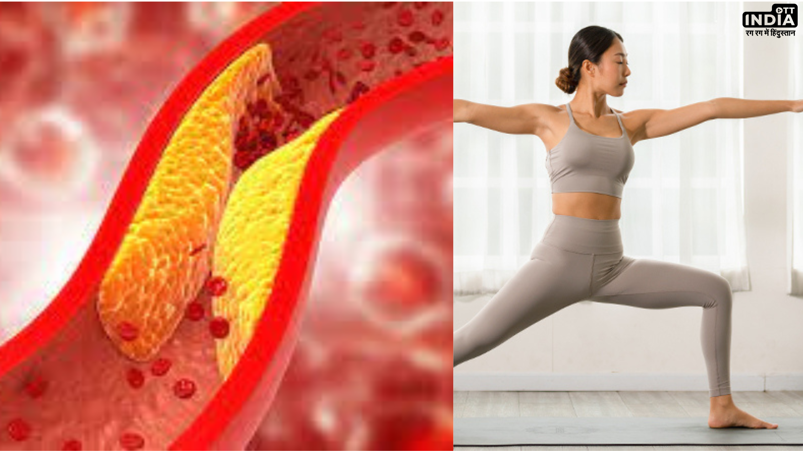 Yoga For Cholesterol: कोलेस्ट्रॉल कम करने में सहायक हैं ये 5 योगासन , मिलेगा आश्र्चर्यजनक लाभ