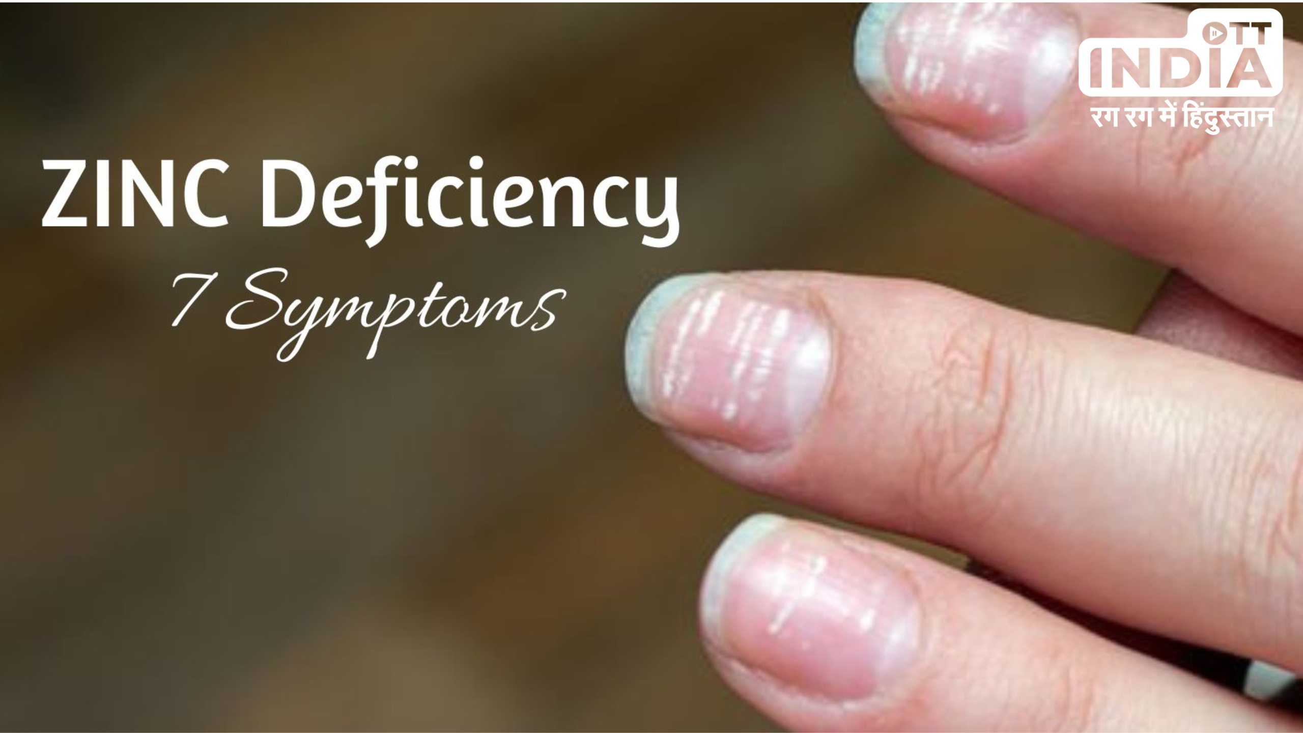 Zinc Deficiency Symptoms: शरीर में  इन 7 लक्षणों को अनदेखा करना पड़  सकता है भारी , जानिये ज़िंक की कमी दूर करने के उपाय