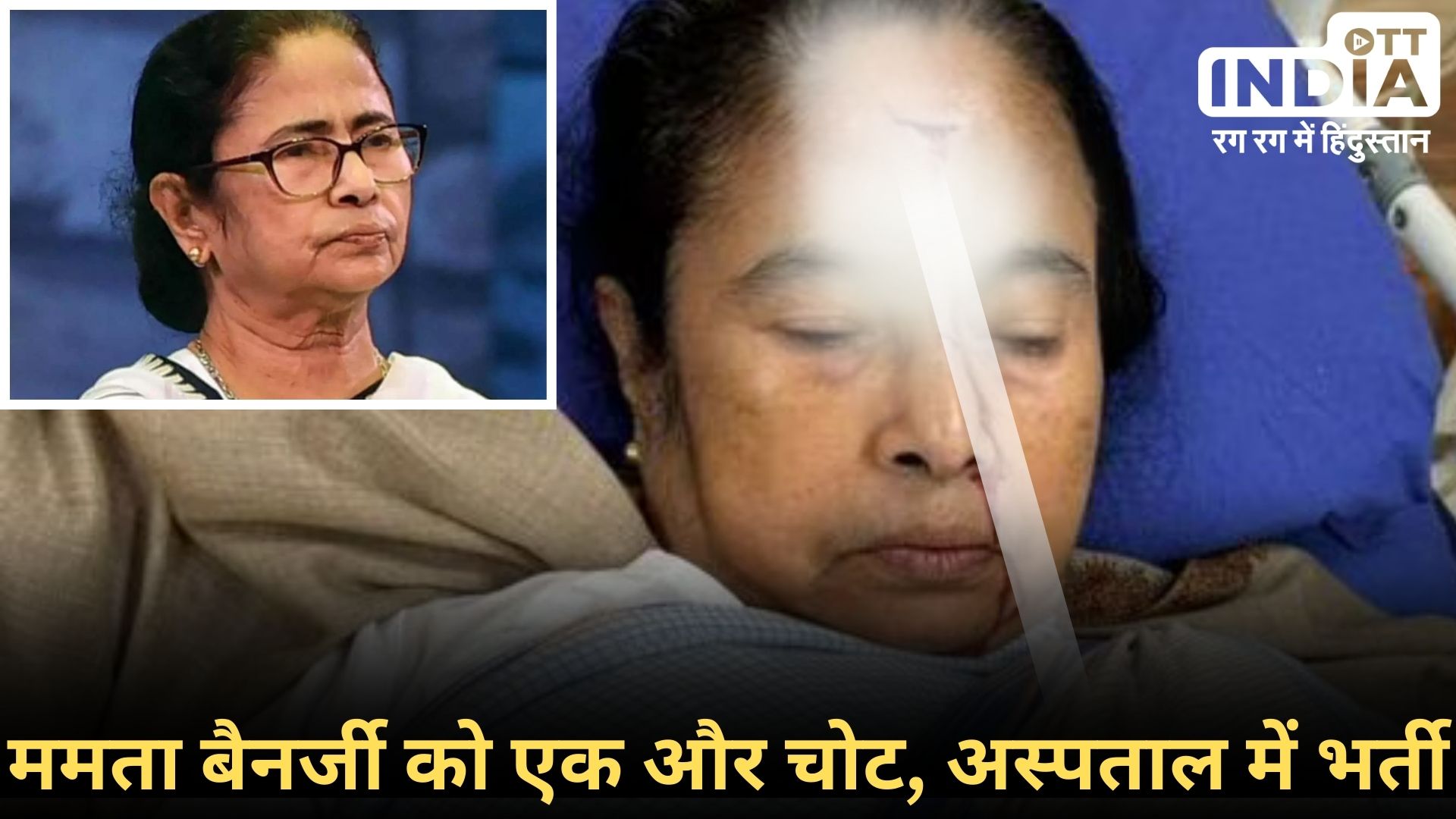 CM Mamata Banerjee: ममता बनर्जी को लगी गंभीर चोट, सोशल मीडिया पर तस्वीर वायरल