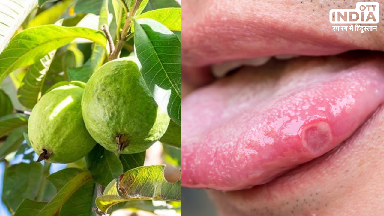 Guava Leaf Benefits: मुंह के छालों की समस्या को झट से दूर करता है ये पत्ता, बस खाली पेट इसे चबा लें