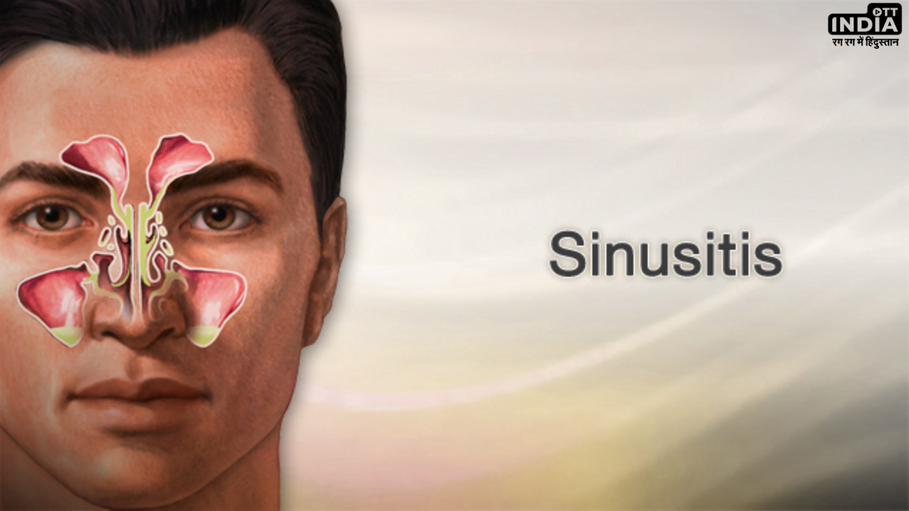 Sinusitis Home Remedies: साइनोसाइटिस क्या है? जानें इसके कारण, लक्षण और घरेलु उपचार
